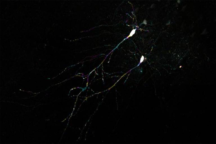 Dr Andrew Macaskill (UCL): Internal state-dependent control of feeding behaviour via the hippocampus